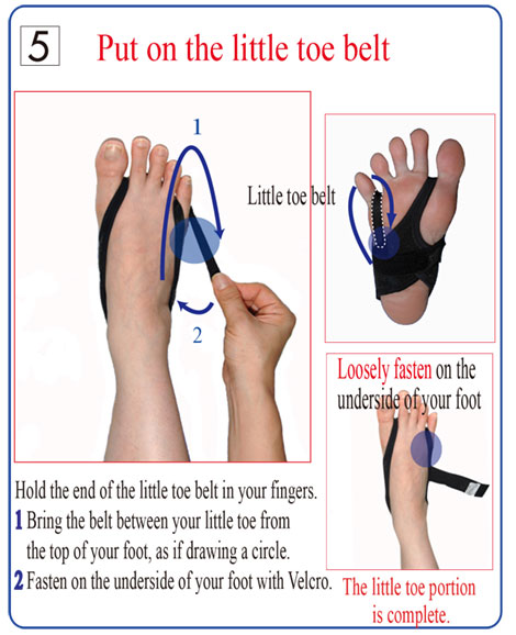 小指用ベルトを足の甲から小指の間に通し、横にマジックテープで留めます。